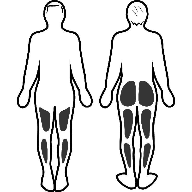 Stimolazione muscolare