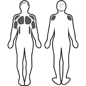 Stimolazione muscolare