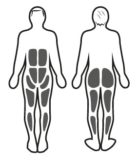 Stimolazione muscolare